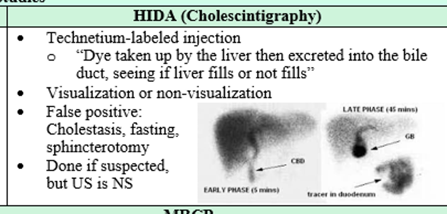 <p>HIDA (Cholescintigraphy)</p>