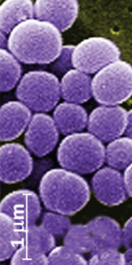 <p>What shape of bacteria is this?</p>