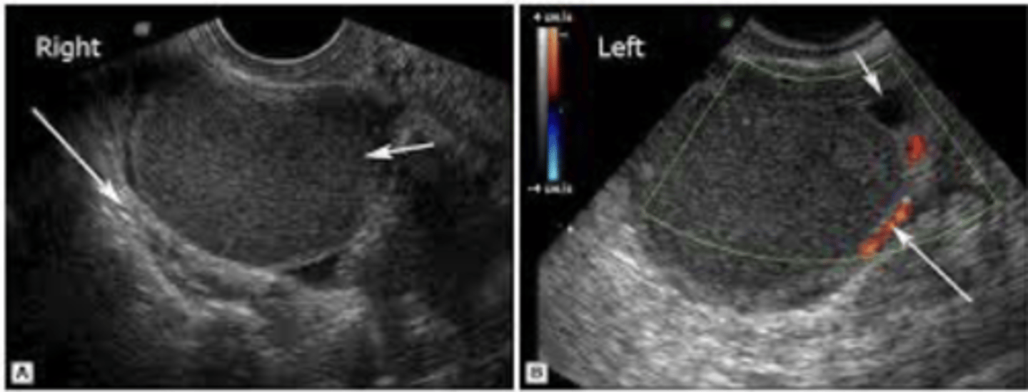 <p>become with a baby inside the body</p>