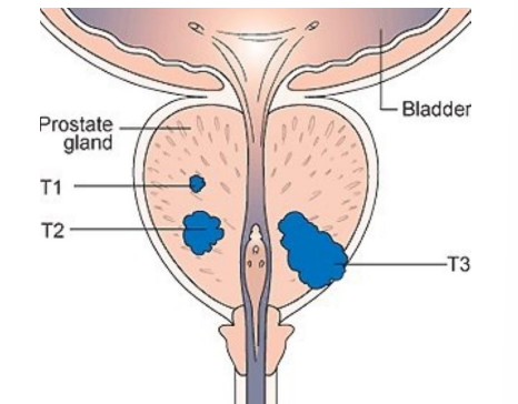 <p>what does this diagram show</p>
