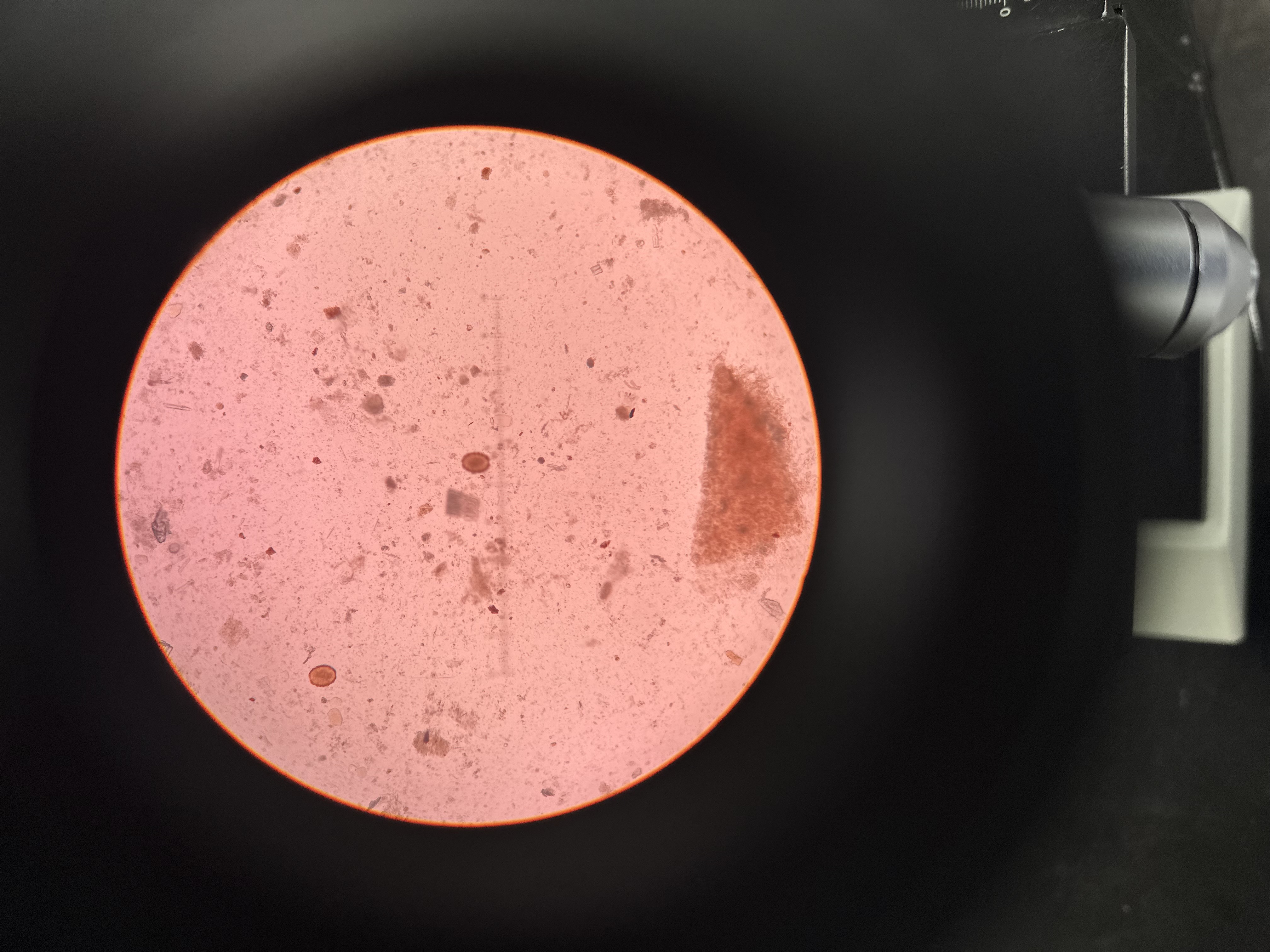 <p>A type of roundworm egg that can be spread through feces, contaminated food, soil, water, etc. </p>