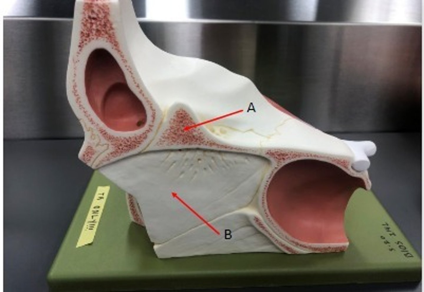 <p>What category of bone is it? What bone is it? Label the structures.</p>
