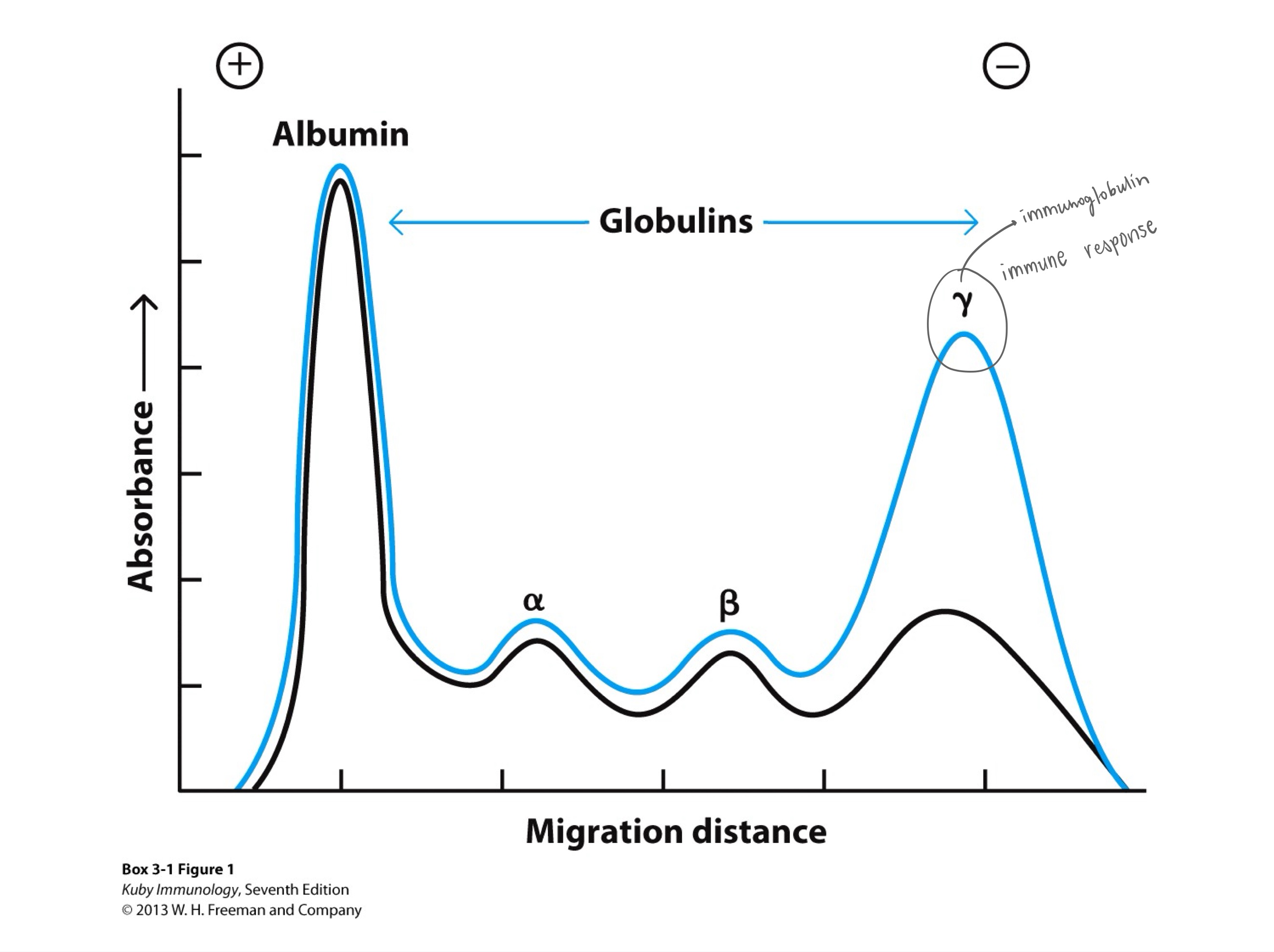 <p>An albumin/globulin graph from protein electrophoresis shows blood proteins separated by size/charge, </p><p>with a large _ peak (transport/oncotic pressure) followed by smaller peaks: </p><p>alpha-1 (AAT), alpha-2 (haptoglobin), </p><p>beta (transferrin/lipoproteins), </p><p>and a broad gamma (antibodies/immunoglobulins) region, </p><p>indicating inflammation (broad gamma/alpha-2) or specific disorders (narrow M-spike for myeloma), with shapes revealing health status. </p>