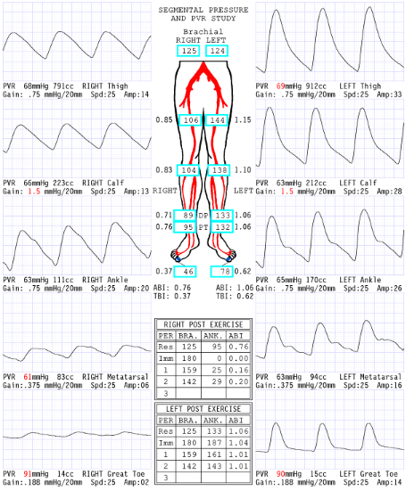 <p><span>Considering waveforms, which side is abnormal?&nbsp;</span></p>