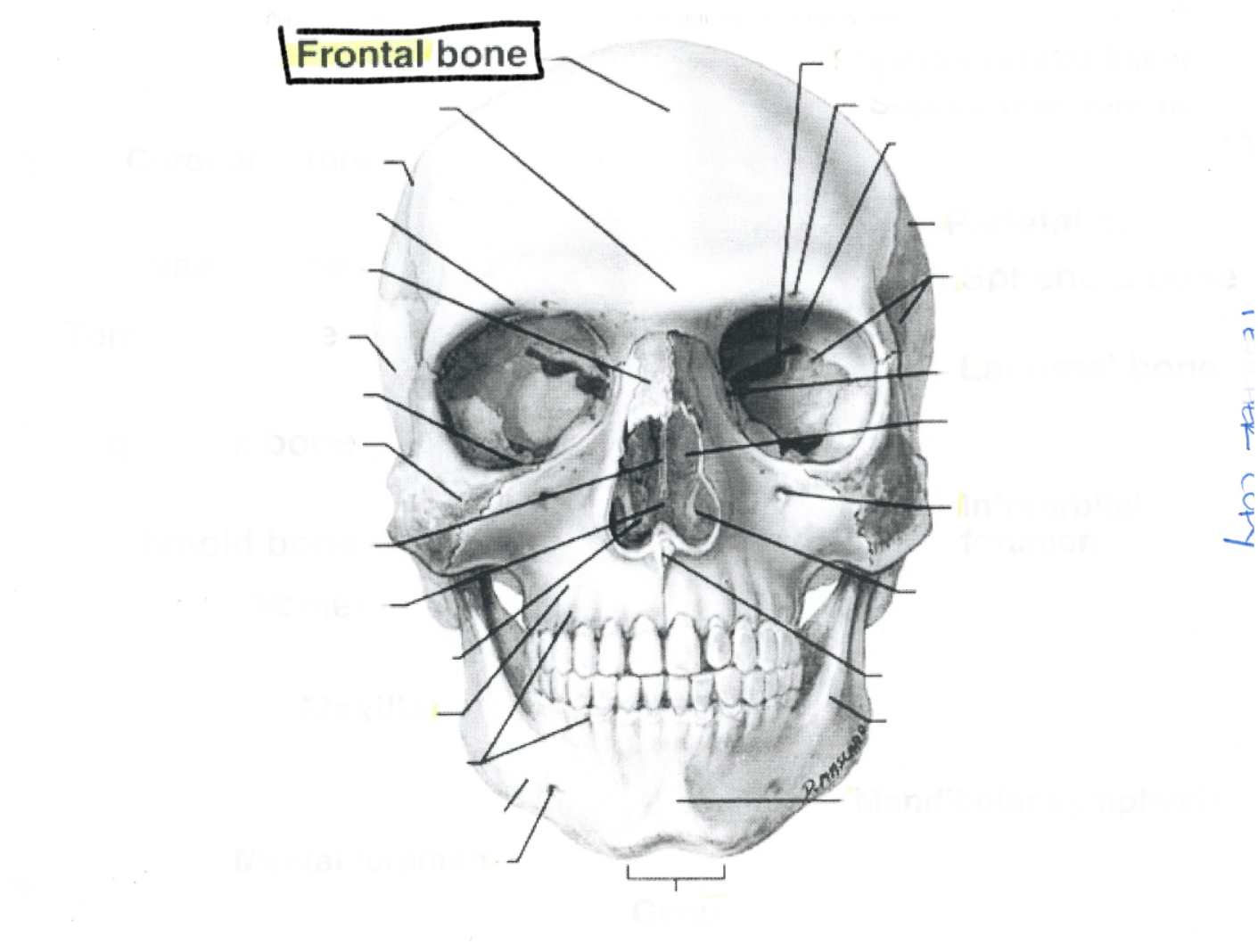 <p>Frontal bone</p>