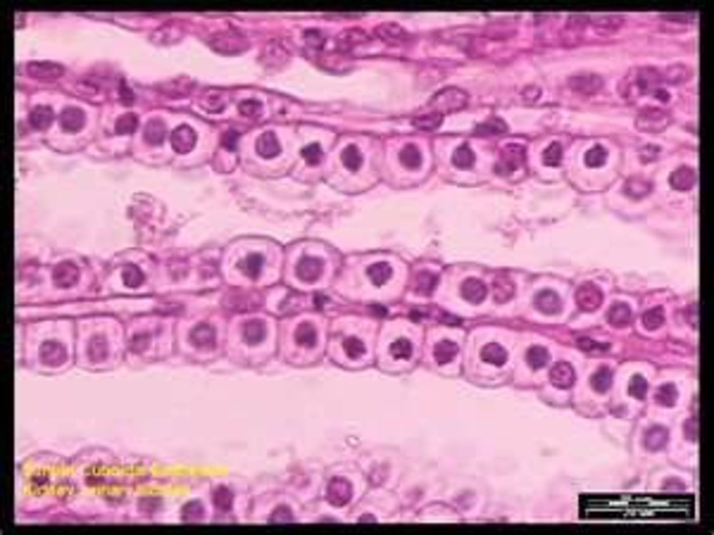 <p>cube-shaped epithelial cells</p>