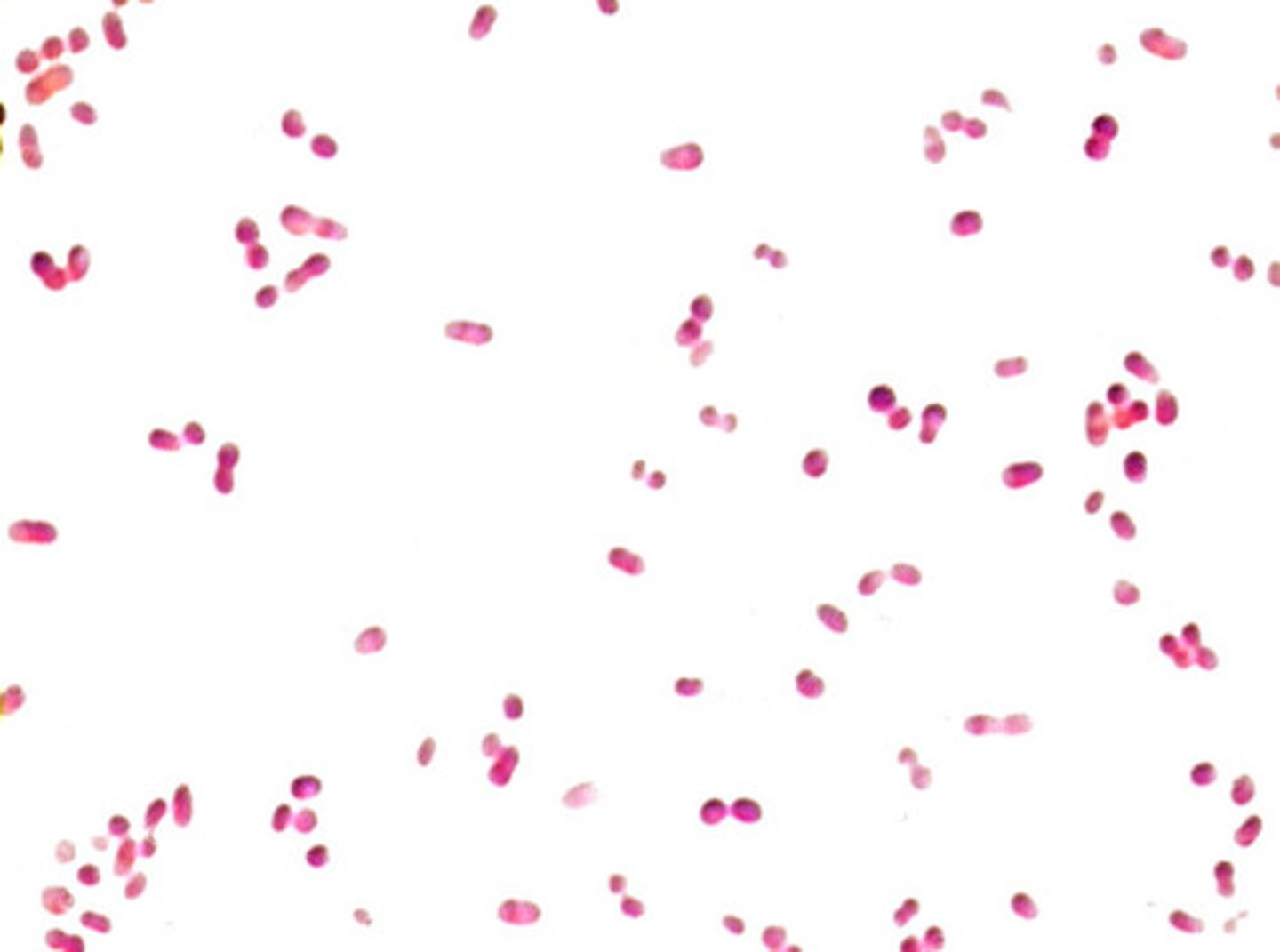 <p>What bacterial morphology is pictured here?</p>