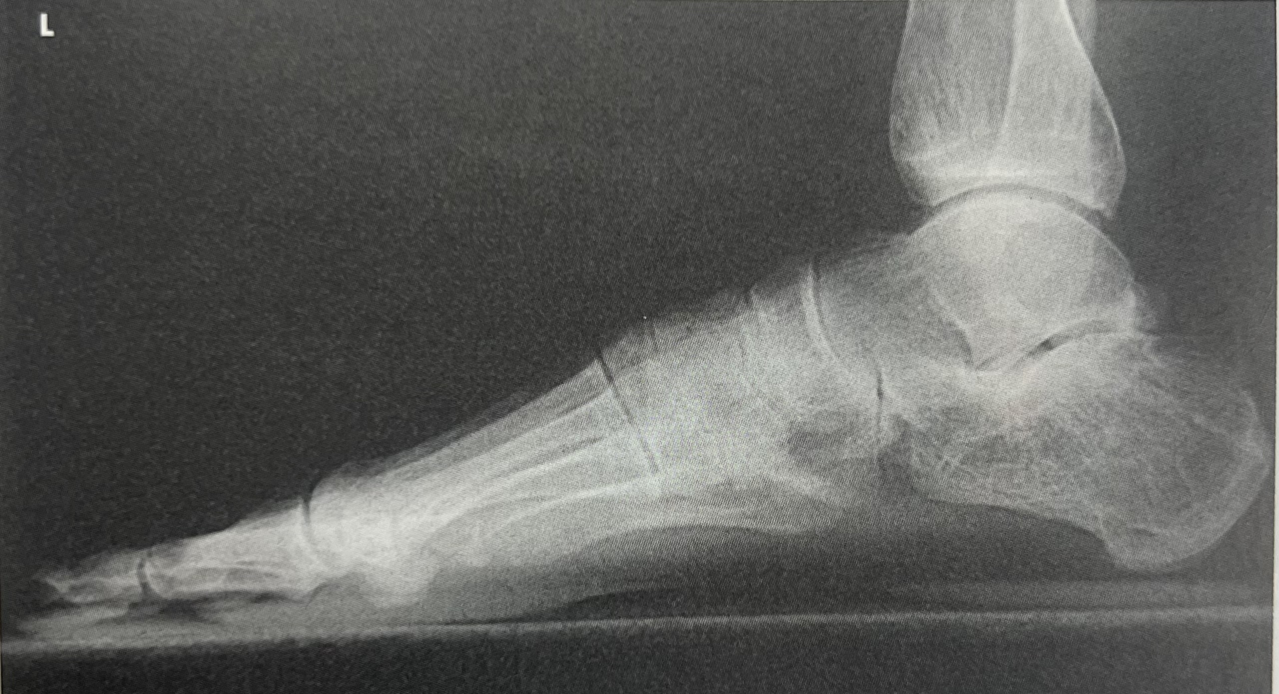 <p>identify part <strong>position</strong> of the image </p>