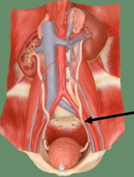 <p>Name this structure.</p>