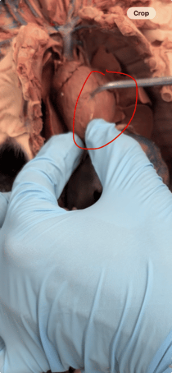 <p>serve heart muscle wall</p>