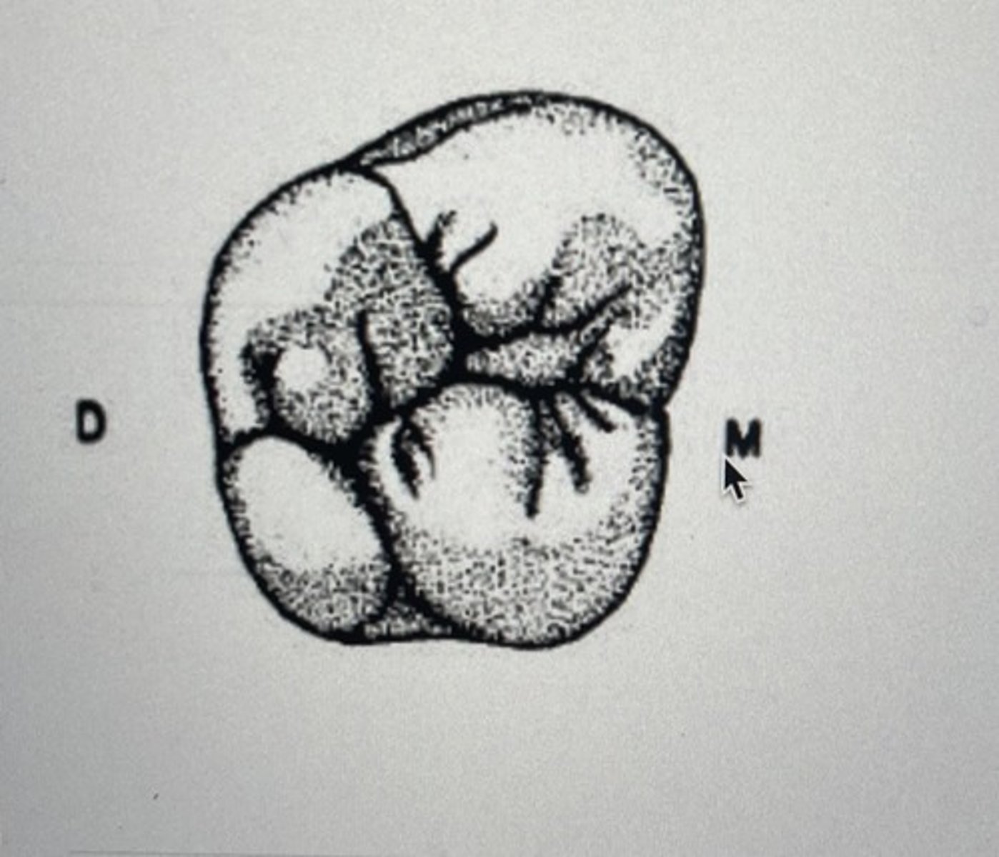 <p>Of the following, which cusp is the smallest cusp on permanent maxillary molars (not including the Cusp of Carabelli)?</p>