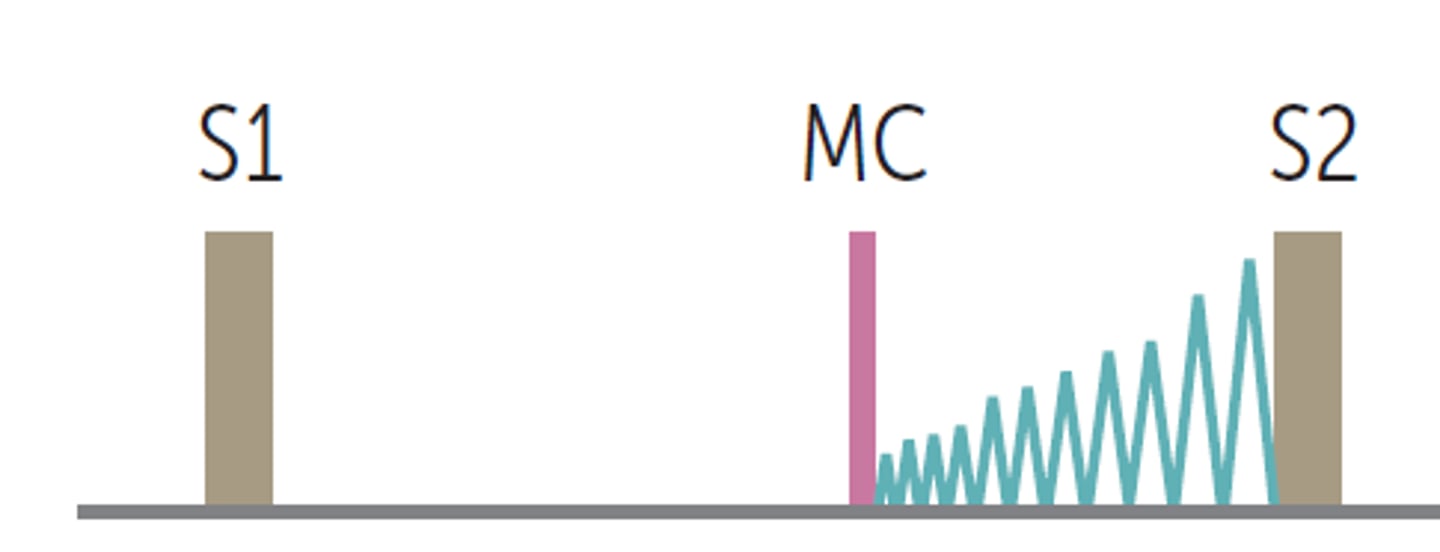 <p>- late systolic murmur</p><p>- mid-systolic click</p><p>- @ apex</p>