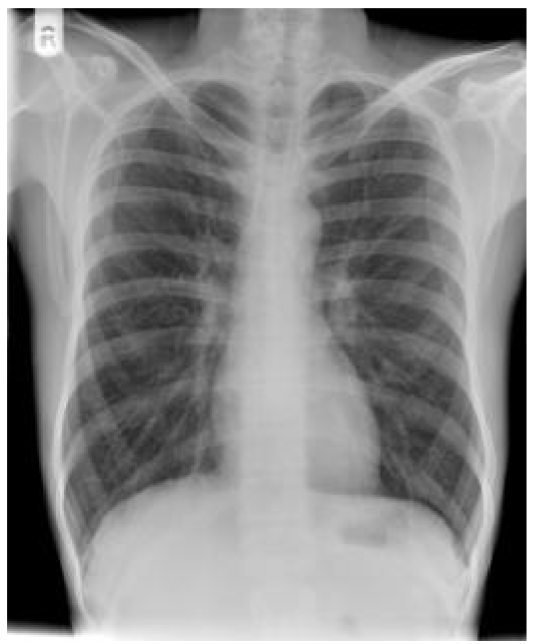 <p>is there anything wrong w this pts diaphragm </p>