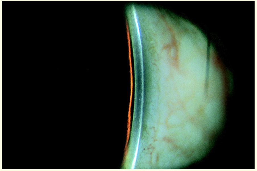 <p>What % is this? </p>