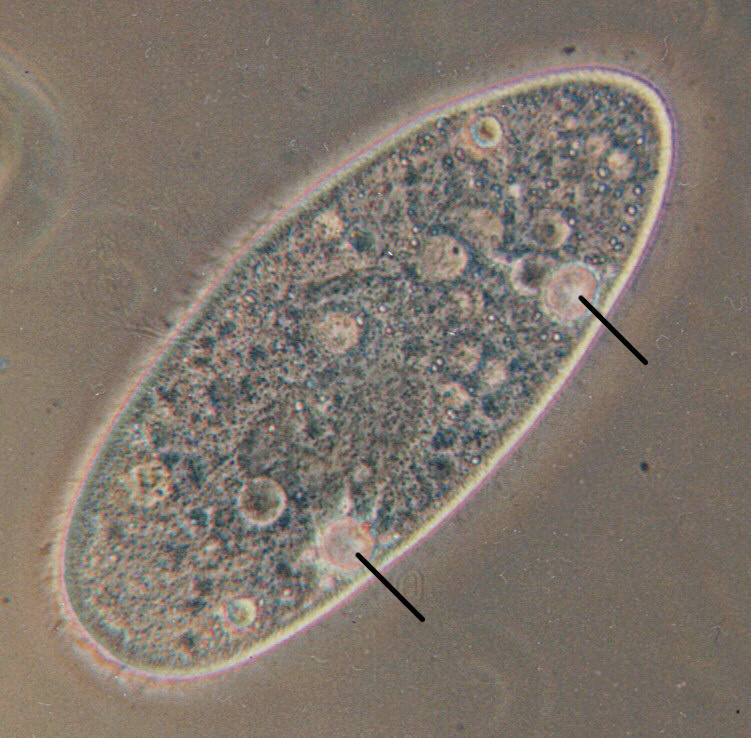 <p><span>Specialized organelles, primarily found in single-celled organisms like protists, that regulate water balance within the cell</span></p>