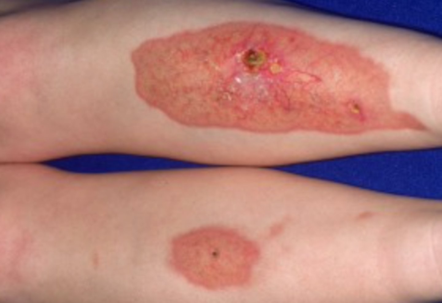 <p>What is the diagnosis?</p>