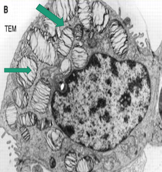 <p>A -Identify the cell<br>B -Identify the labelled structure</p>