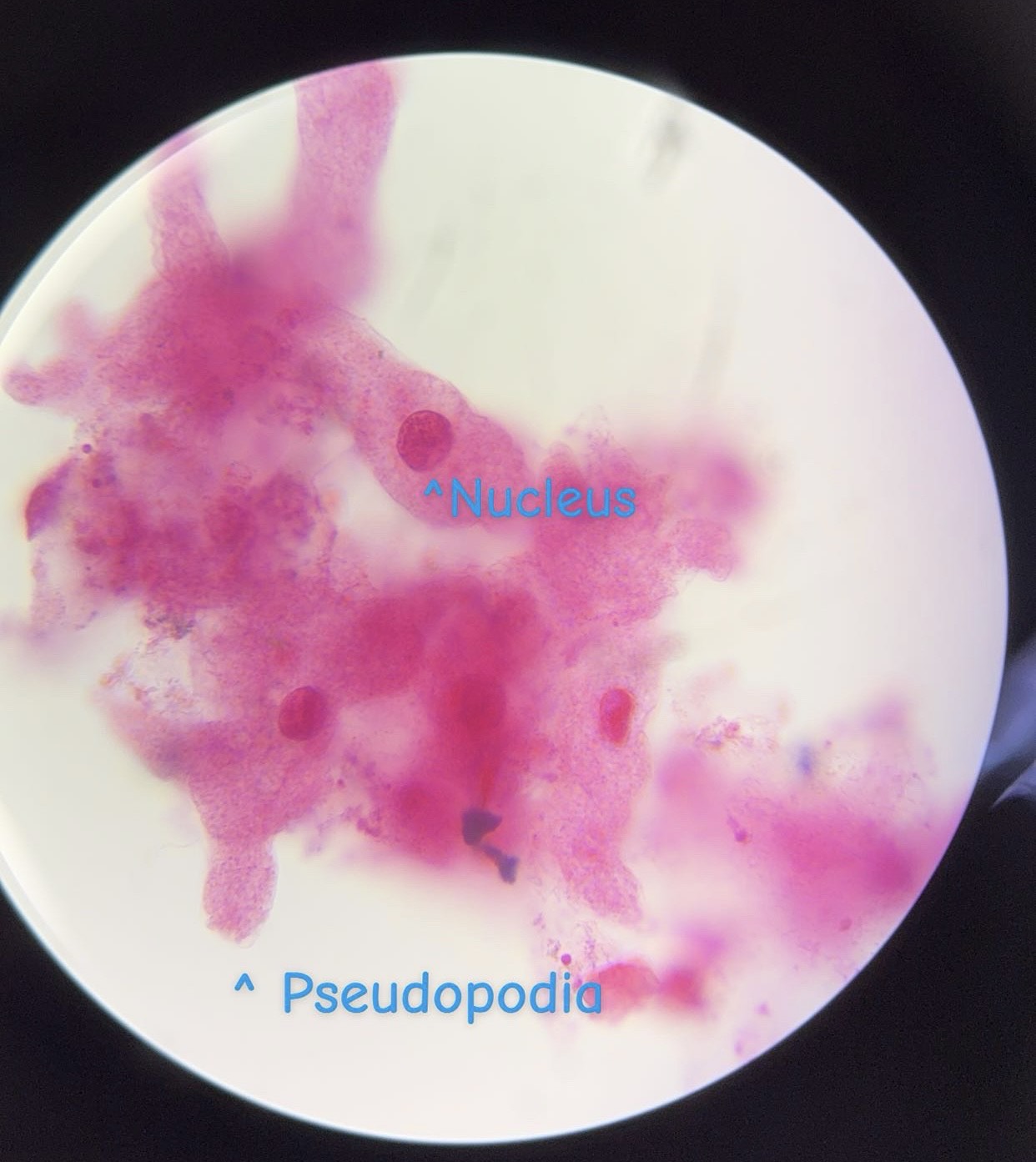 <p><span>What is this organism?</span></p>