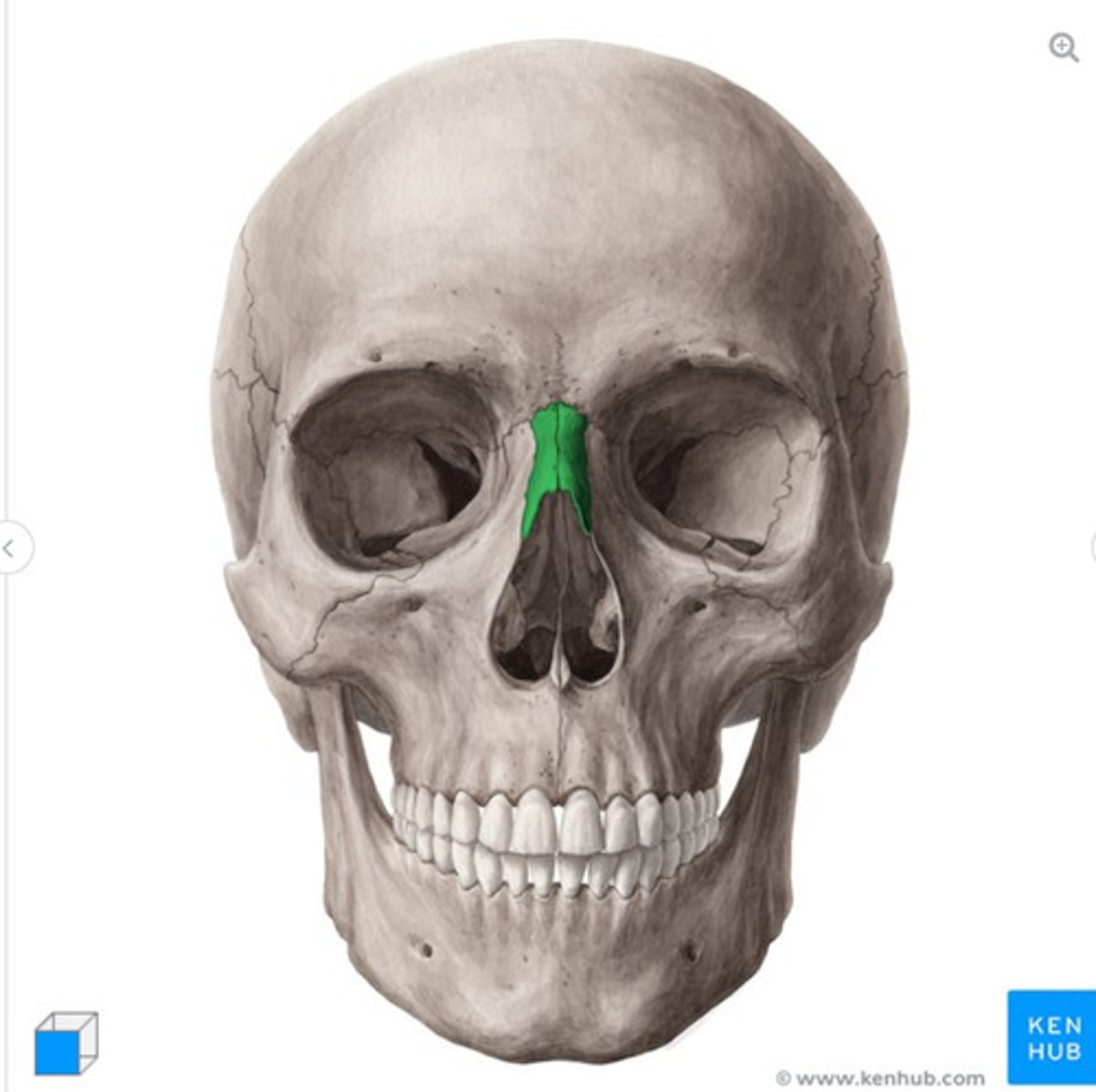<p>What is this bone?</p>