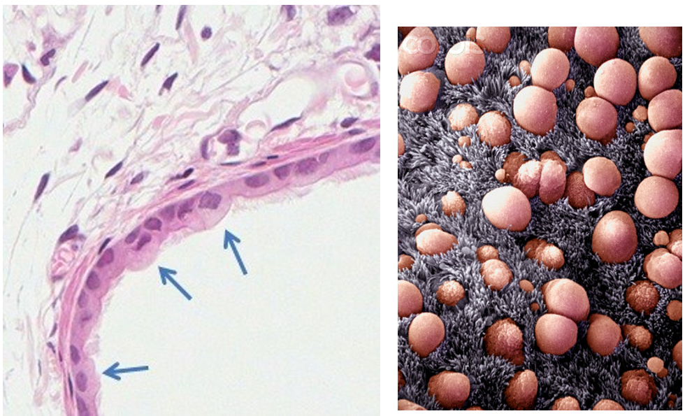 <p>What happens to<strong> clara cells </strong>and<strong> submucosal glands</strong> in <strong>bronchioles?</strong></p>