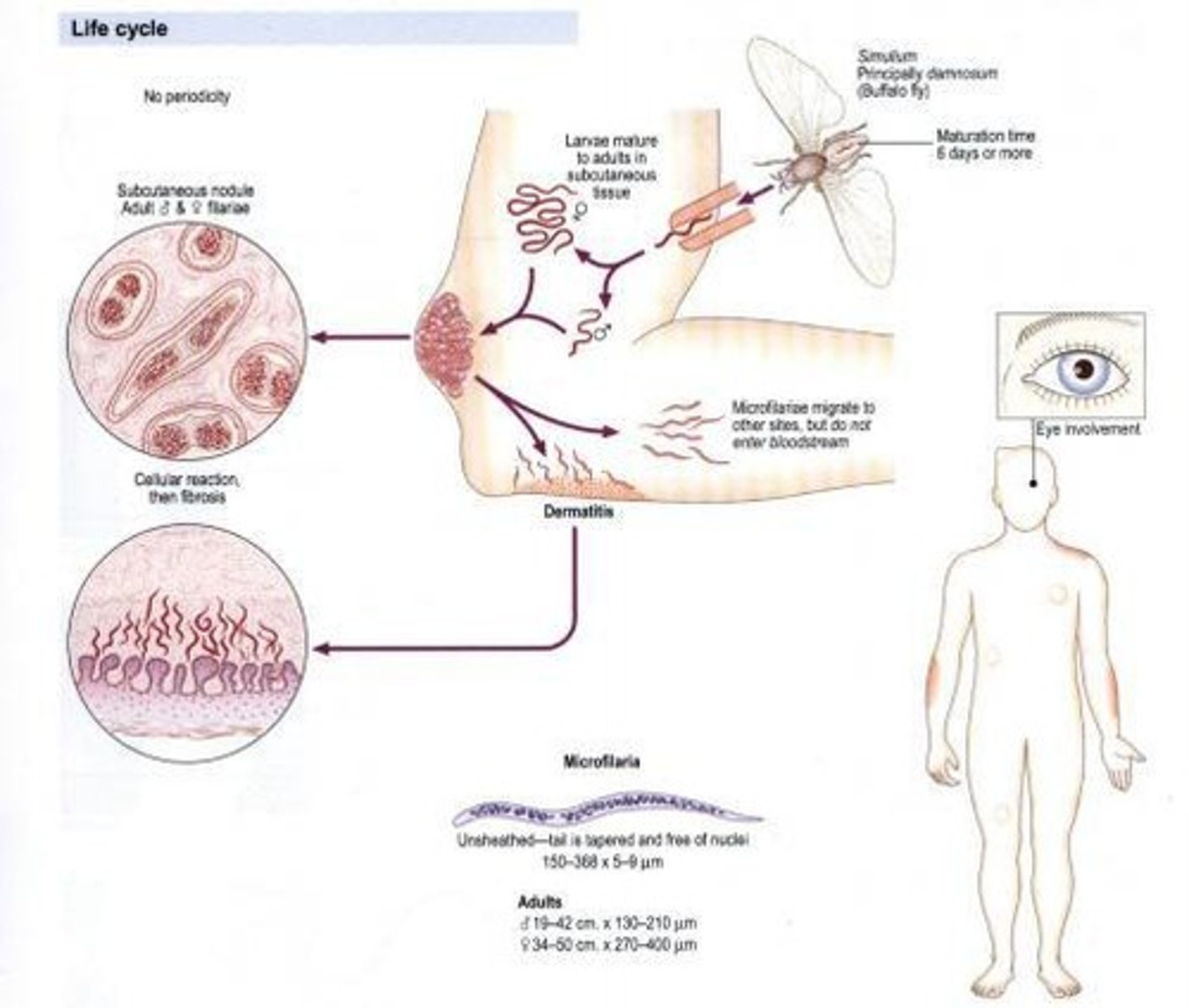 <p>Other name: Convoluted filaria, Blinding worm. Habitat: Subcutaneous tissue. Vector: Blackfly/Buffalo gnat (Simulium damnosum). Disease: Blinding filariasis, River blindness, Onchocercomata, Hanging groin, Leopard skin.</p>