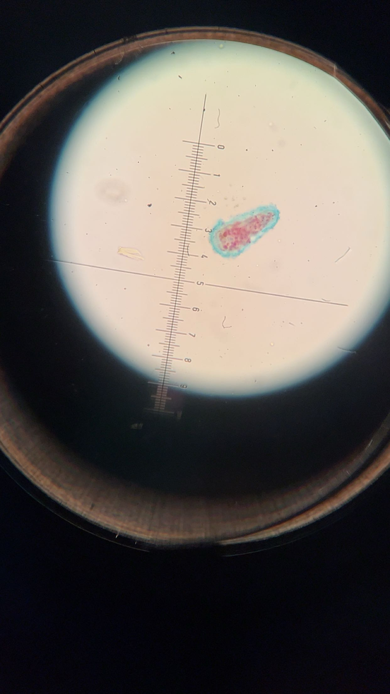 <p><em>Fasciola hepatica</em> miracidium</p>
