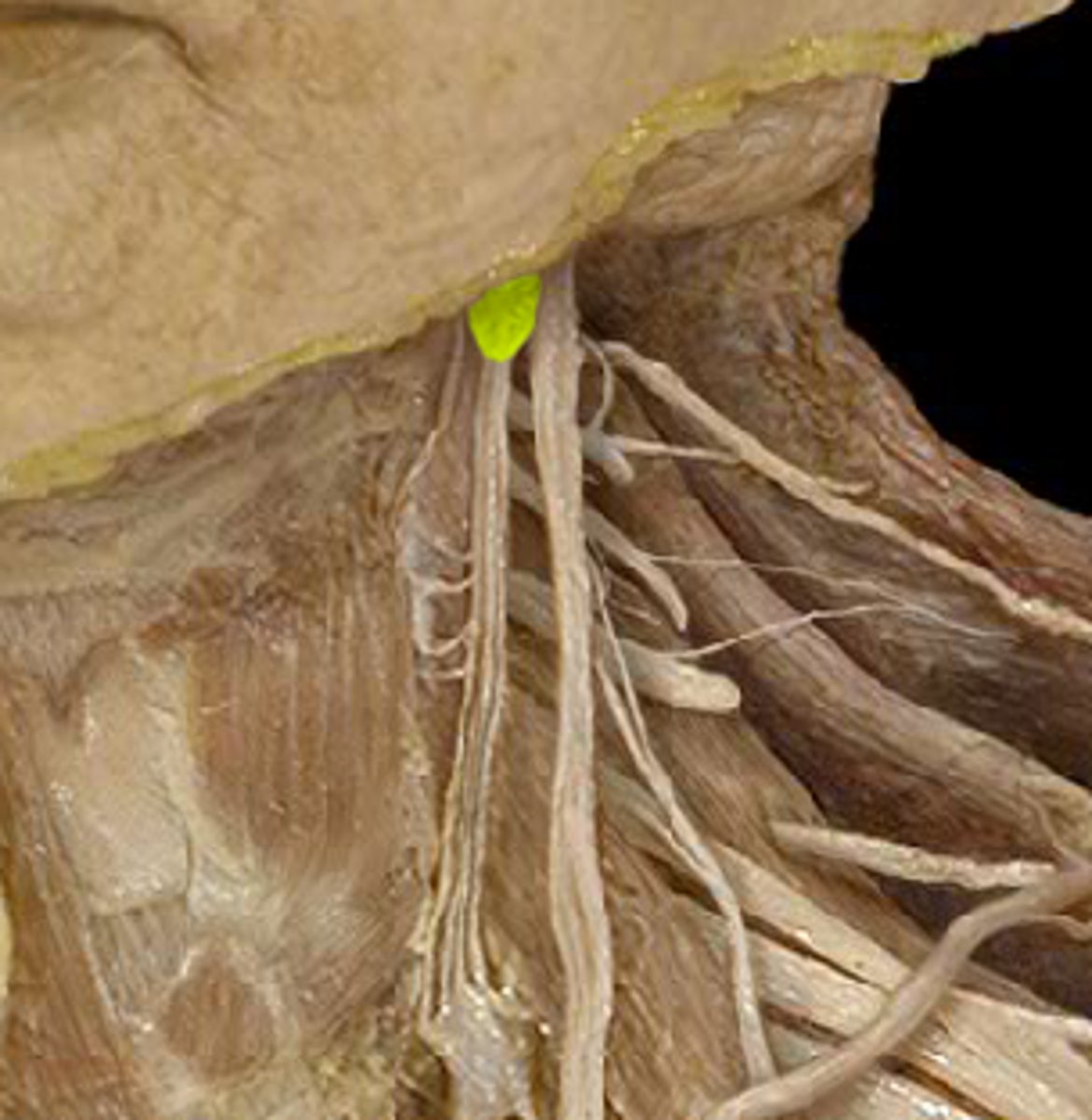 <p>superior cervical ganglion</p>