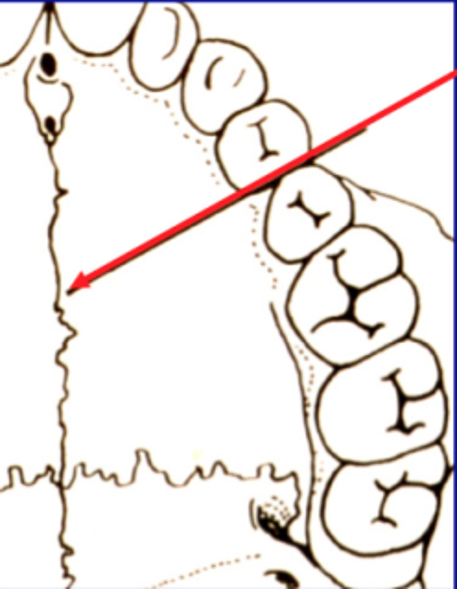 <p>extends from the incisive papilla to the distal end of the hard palate.</p>