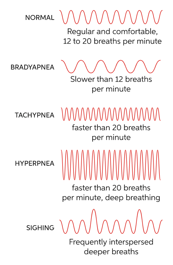 <p><strong>Quiet breathing</strong></p><ul><li><p>AKA eupnea</p></li><li><p>occurs at rest and does not require the cognitive thought of the individual.</p></li><li><p>diaphragm and ______ intercostals must contract.</p></li></ul>