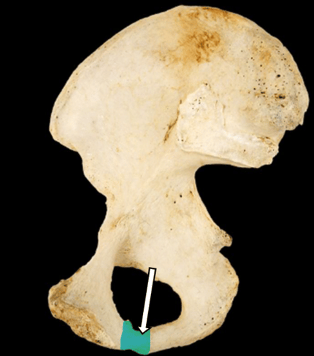 <p>name the part</p>