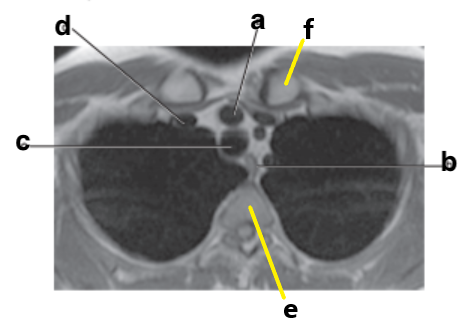 <p>What is letter b ?</p>