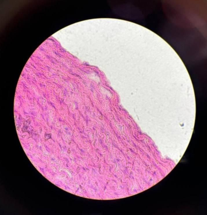 <p>Identify the tissue and mention one site</p>