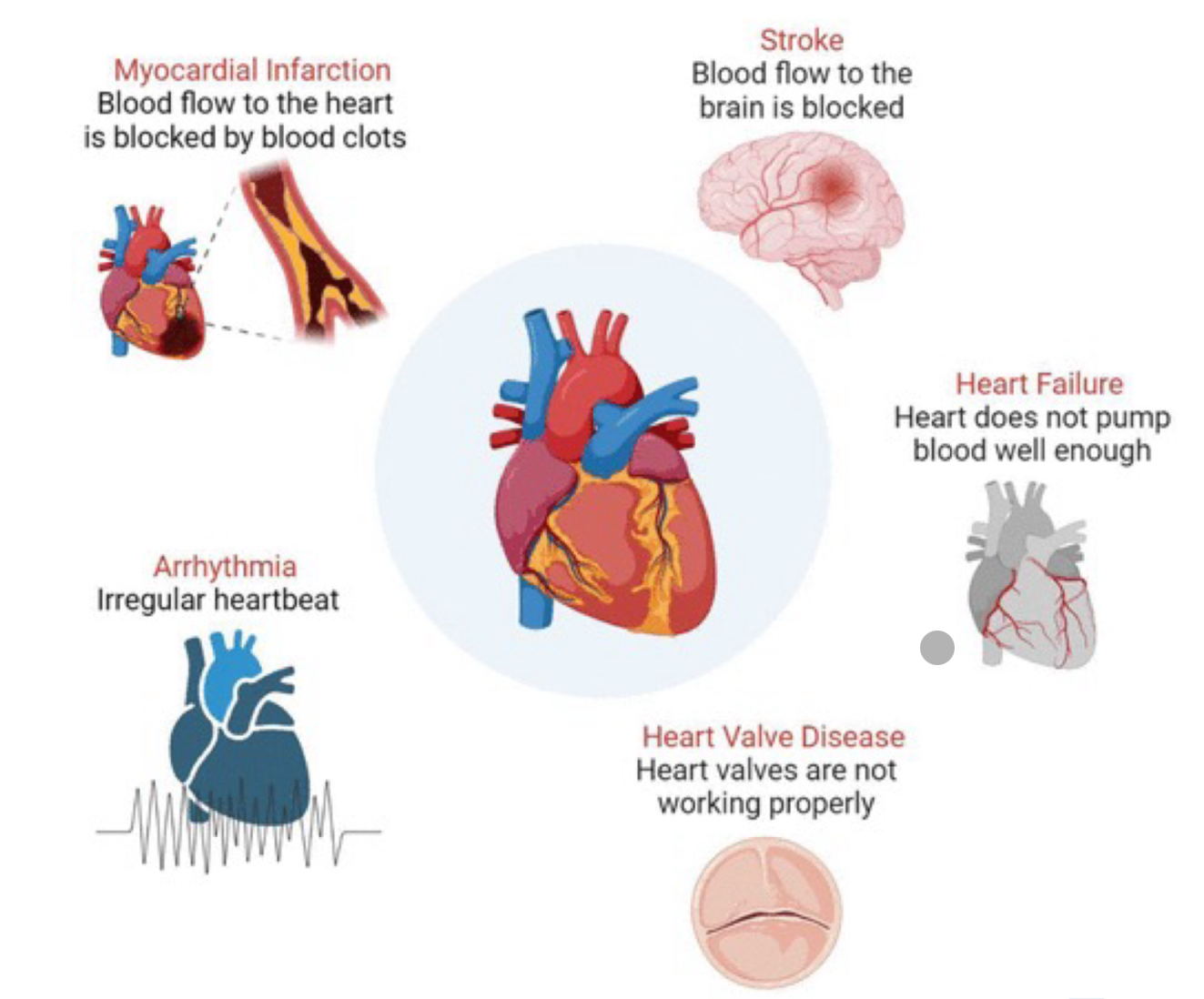 <p><strong>arterial stiffening (hardening)</strong>: reduced elasticity of arteries → increased afterload on the heart, contributing to hypertension and impaired blood flow</p><p><strong>decreased elasticity of heart tissues</strong>: reduced compliance of heart muscle → impaired filling of the heart chambers, potentially leading to heart failure</p><p><strong>reduced cardiac output</strong>: decline in the heart’s ability to pump blood → decreased blood flow to tissues and organs</p><p><strong>valve changes</strong>: thickening and stiffening of heart valves → impaired valve function, potentially leading to regurgitation or stenosis</p><p><strong>decline in baroreceptor sensitive</strong>: reduced responsiveness of baroreceptors in blood vessels → impaired ability to regulate blood pressure in response to changes</p><p><strong>increased risk of atrial fibrilation</strong>: higher likelihood of irregular heart rhythms → elevated risk of stroke due to blood clot formation</p>