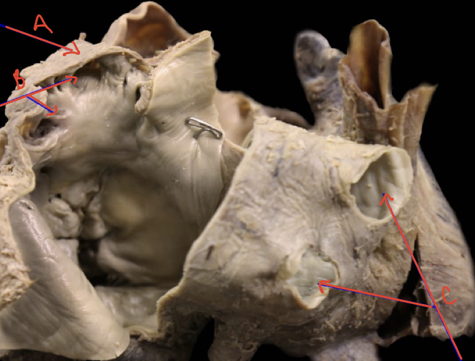 Left atrium internal posterior 
