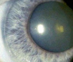 <p>identify </p>