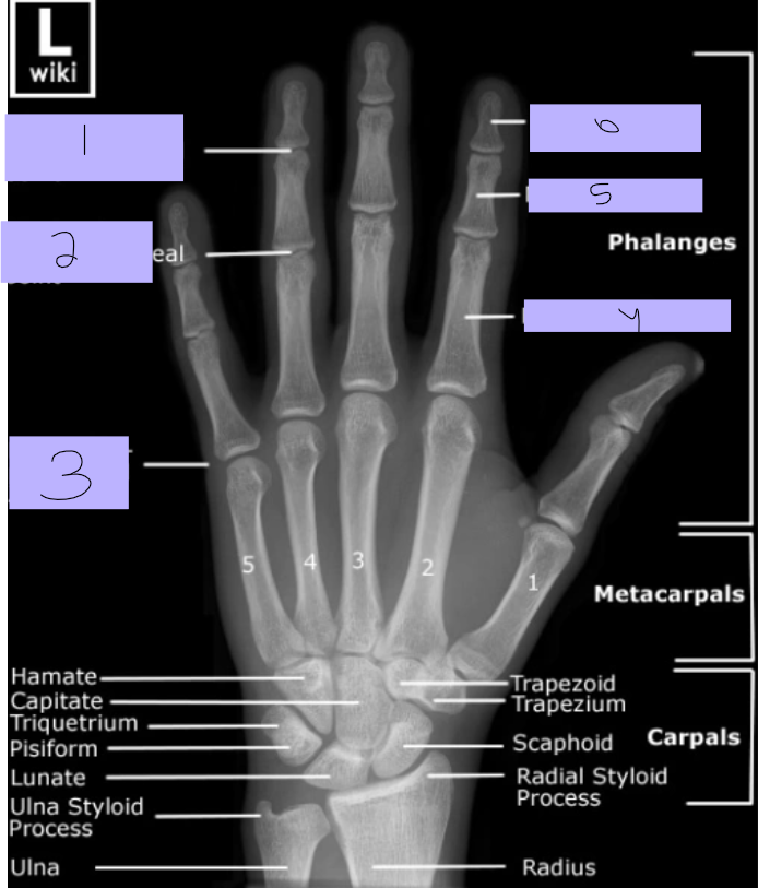 <p>#5</p>