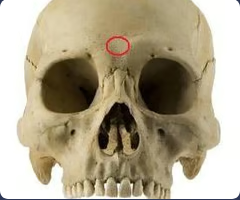 <p>Most anterior midline point on the frontal bone, usually above the frontonasal suture</p>