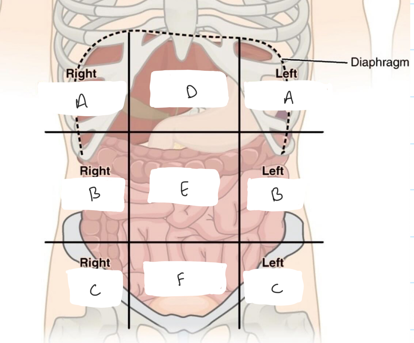 term image