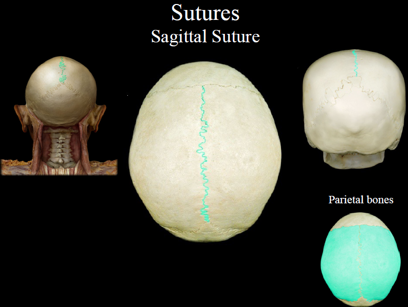 <p>the suture uniting the two parietal bones</p>