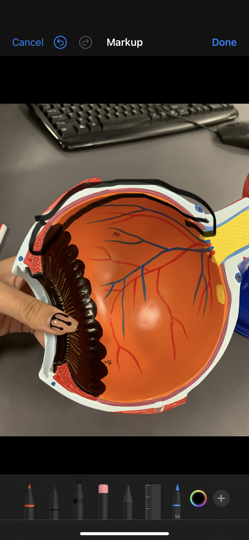 <p>Purple inside eye </p>