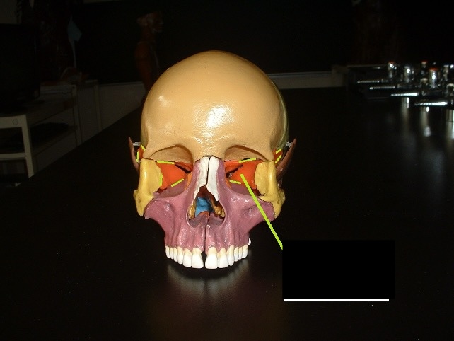 <p>well surrounded by other bones; looks like a bat (when removed).</p>