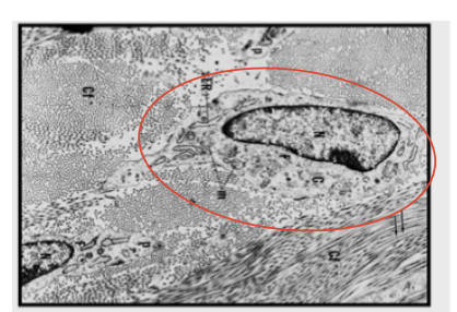 term image