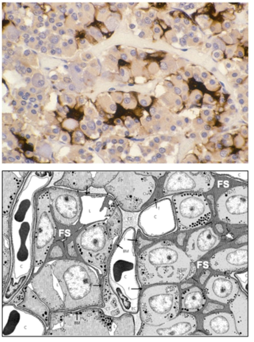 <p>What has the following characteristics?</p><p>- Devoid of granules, occupy - 10% of anterior pituitary</p><p>- Form cell clusters ("follicles")</p><p>- Dendritic morphology</p><p>- Possess gap junctional connections to other FS cells and to acidophils/ basophils</p>