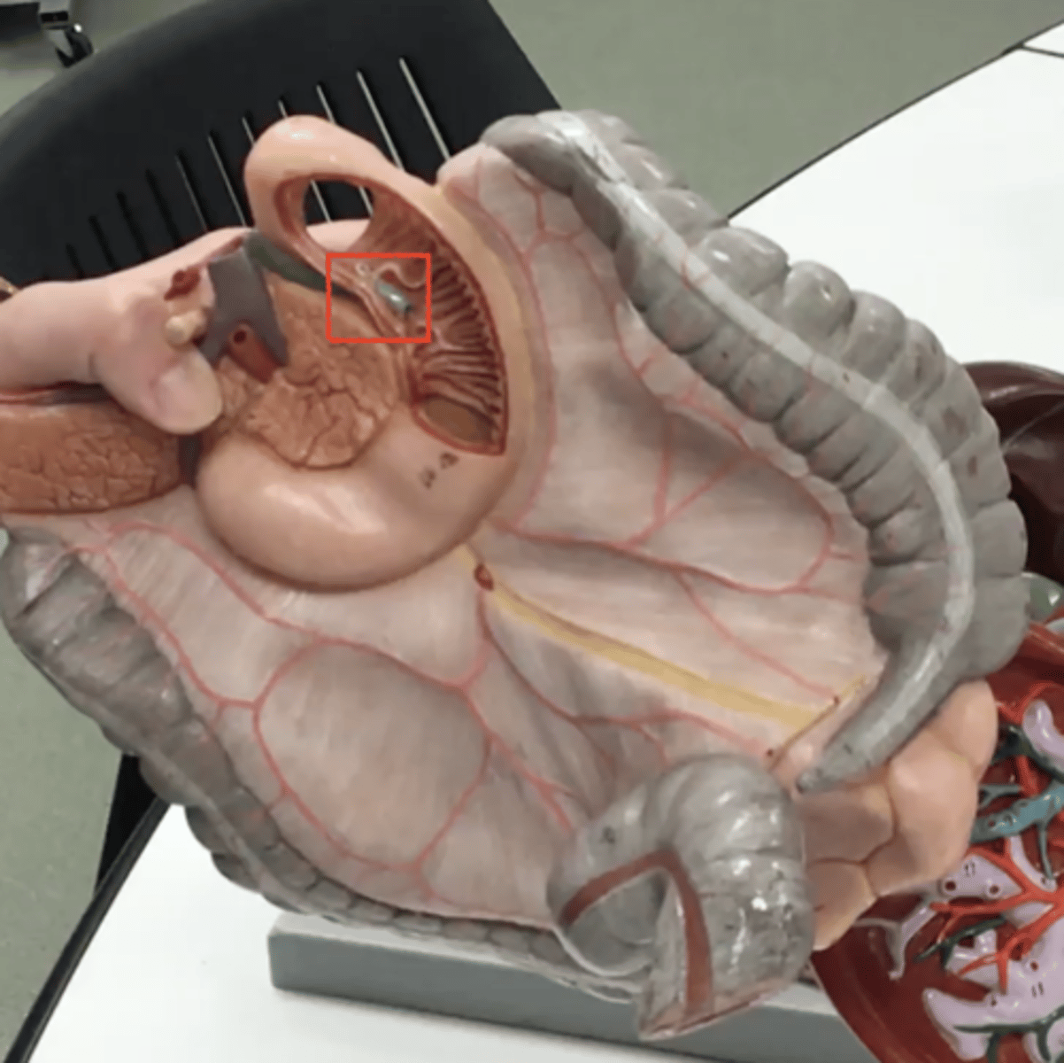 <p>name the muscle- raised part under ampulla</p>