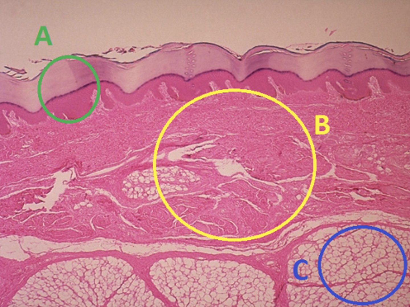<p>Answer the following questions based on the features indicated in the following image. Which letter indicates the administration site for the tuberculin skin test?</p>