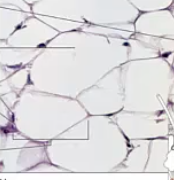 <p>tissue type</p>