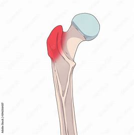 <p>What bone structure is this?</p>