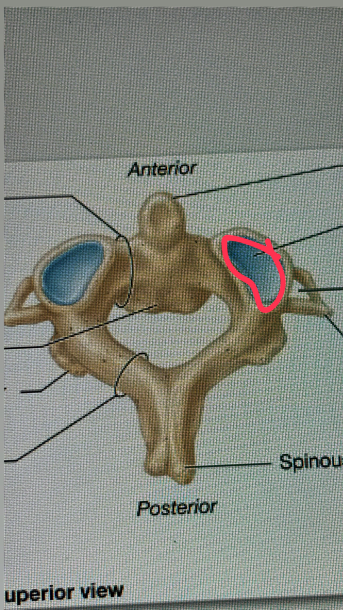 <p>the part that connects with the bottom articular facet</p>