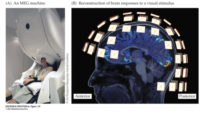 <p>Magnetoencephalography (MEG): similar to EEG: measures changes to magnetic fields produced by the electrical activity of neurons.</p><p>• MEG has the same high temporal resolution as EEG.</p><p>• MEG has better spatial resolution than EEG b/c magnetic signals are less distorted by the skull than electrical signals.</p><p>Downsides: Expensive, Technical</p>