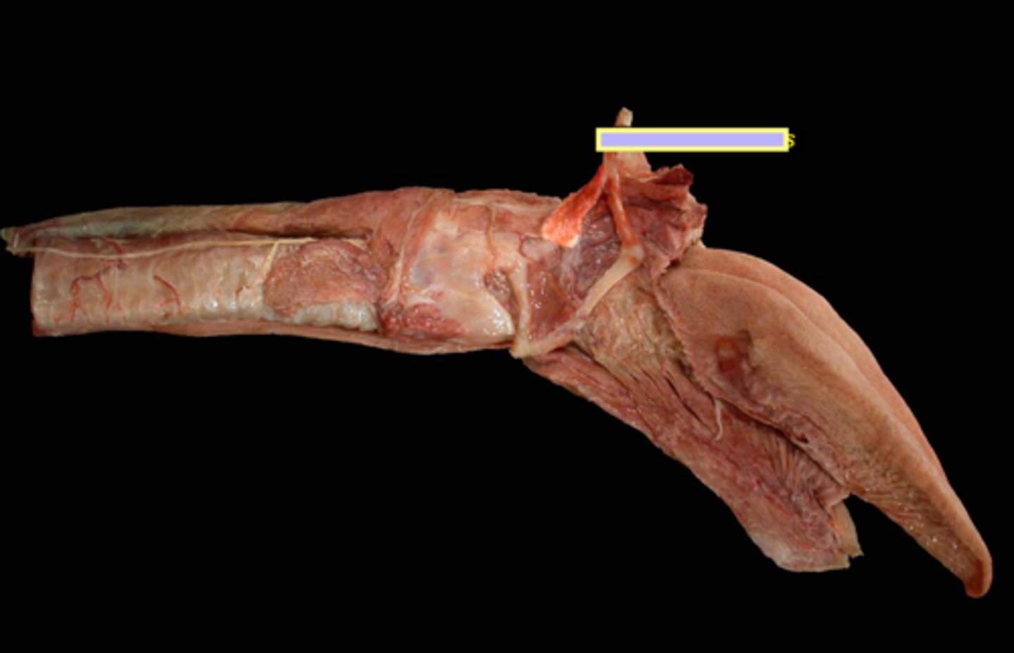 <p>Muscles of the phaynx:</p><p>enlarges the pharynx during swallowing</p>